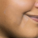 Pimple Patch XL – 10 Extra-Large Hydrocolloid Patches for Face and Body