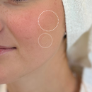 Pimple Patch Multi-Size Pack – 105 Hydrocolloid Patches in 5 Sizes with Tea Tree Oil